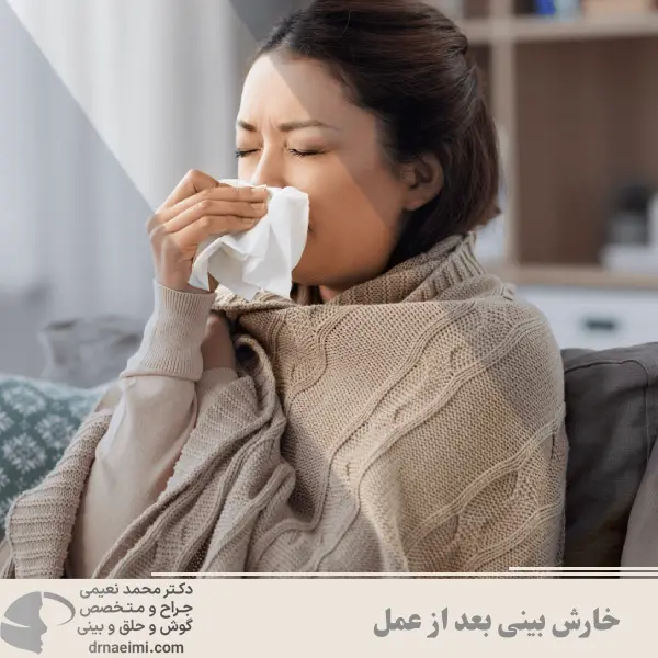 خارش بینی بعد از عمل _ دکتر مجمد نعیمی