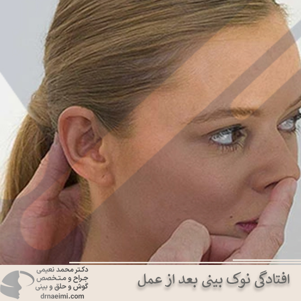 افتادگی نوک بینی بعد ازعمل _ دکتر محمد نعیمی 