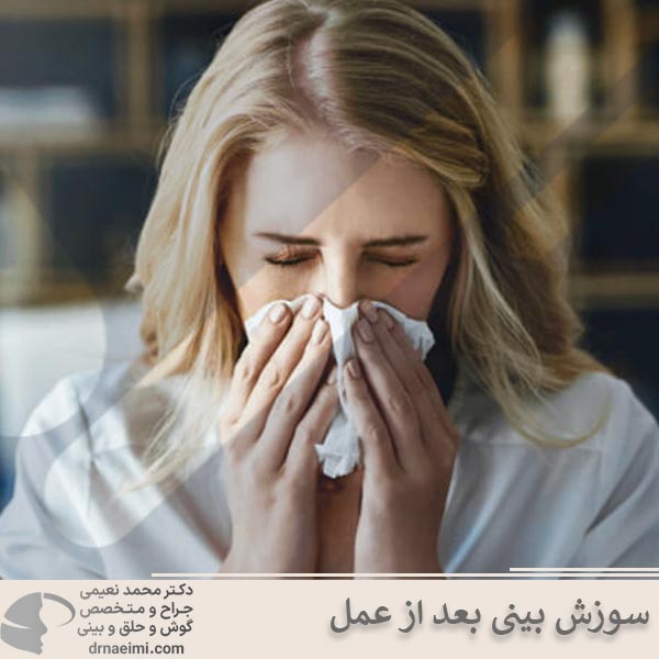 سوزش بینی بعد از عمل _ دکتر محمد نعیمی